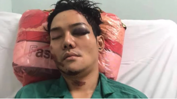 Con trai Hoài Linh bị tai nạn rất nghiêm trọng, nhận được sự giúp đỡ tận tình từ các nghệ sĩ