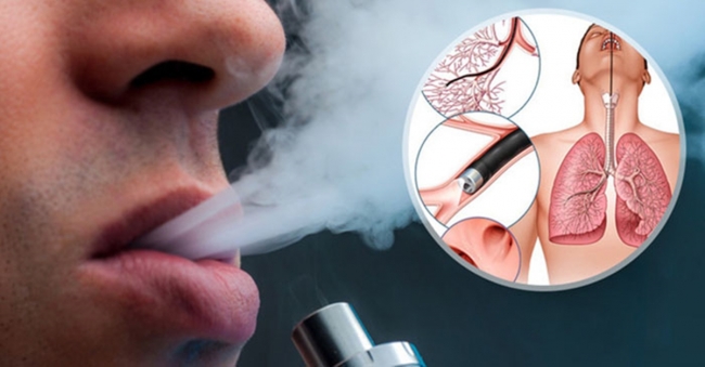 Hút thuốc lá điện tử có khả năng làm tăng nguy cơ lây nhiễm Covid-19