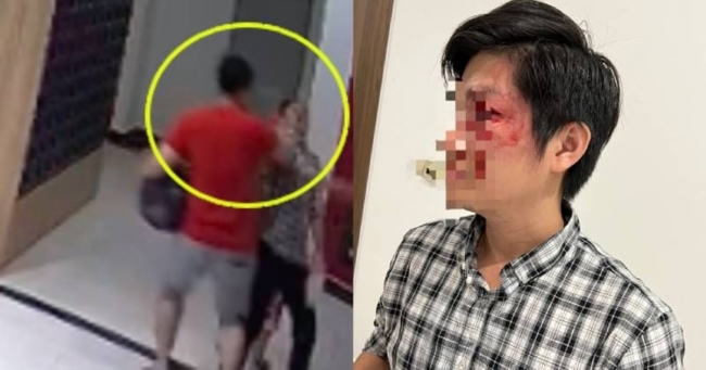 Luật sư tiết lộ mức án chủ chó hành hung người cha bảo vệ con khỏi chó thả rông có thể phải nhận