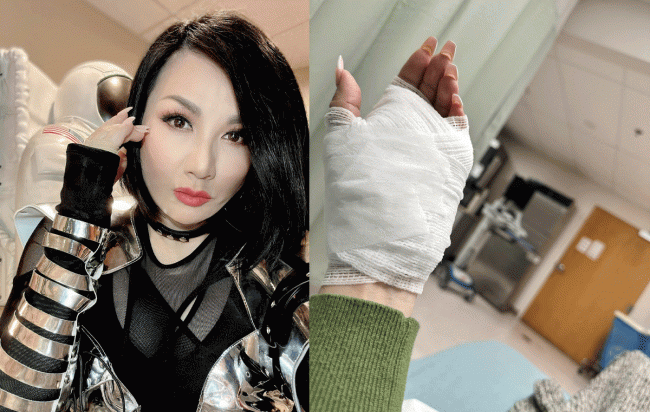 Trizzie Phương Trinh nói về những đau đớn vừa trải qua khi đi cắt chỉ vết thương: ‘Thốn đến xương’