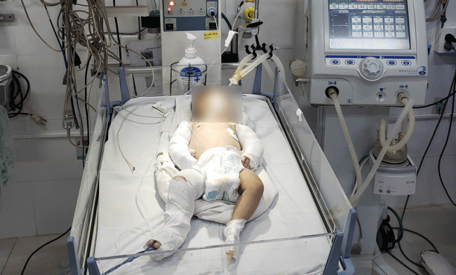 Nguyên nhân và quá trình bé gái hơn 2 tháng tuổi ở Đà Lạt bị bạn trai của mẹ bạo hành tàn độc