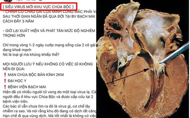 Thực hư dịch virus lạ gây “viêm cơ tim” làm hoảng loạn CĐM 