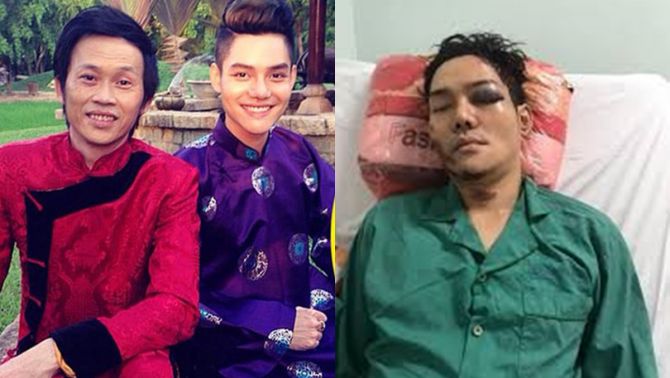 Con trai nuôi Hoài Linh gặp tai nạn khủng khiếp khi đi ship hàng, người thân lắng 