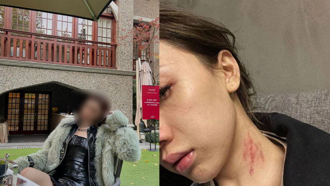 Sao nữ trẻ đình đám bức xúc ‘tố’ bị người yêu ‘tác động vật lý’ và lây nhiễm bệnh nhạy cảm