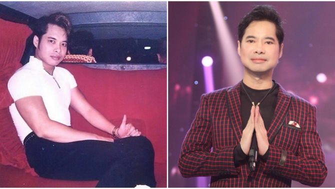 Quá khứ của Ngọc Sơn: ‘dại gái’ đến mức ngã nặng, để lại vết sẹo dài dưới môi