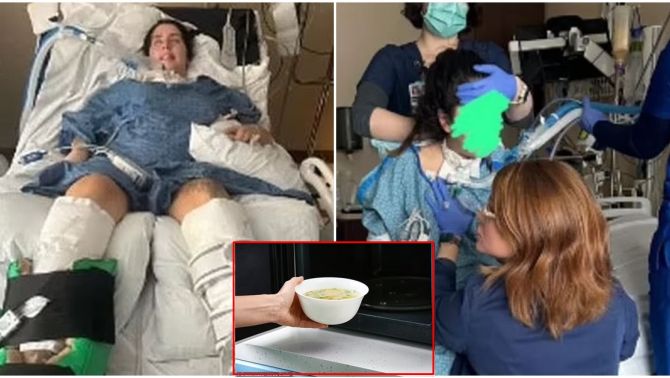 Ăn phải canh hâm nóng không đúng cách, cô gái 23 tuổi bị liệt và phải thở máy