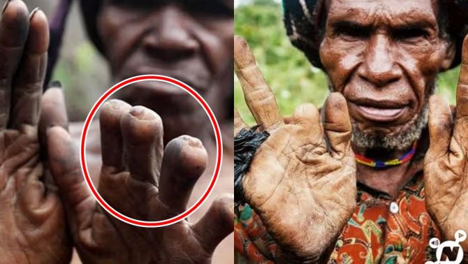 Bộ tộc có hủ tục rùng rợn: Phụ nữ phải cắt cụt ngón tay khi người nhà mất, càng thân thiết càng mất nhiều ngón!