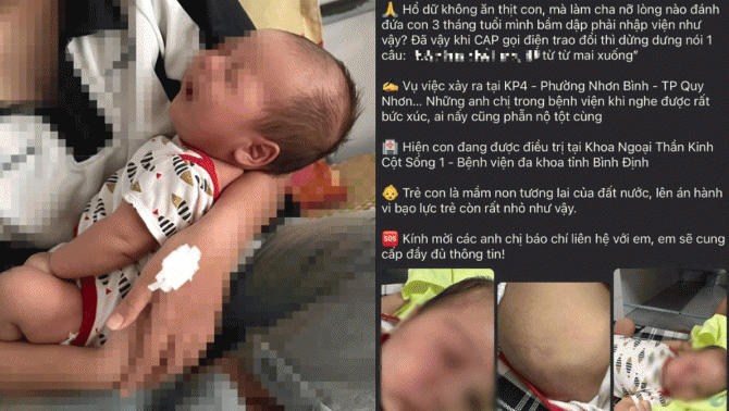 Bình Định: Công an làm rõ thông tin cháu bé 3 tháng tuổi bị cha bạo hành, đánh đập đến nhập viện
