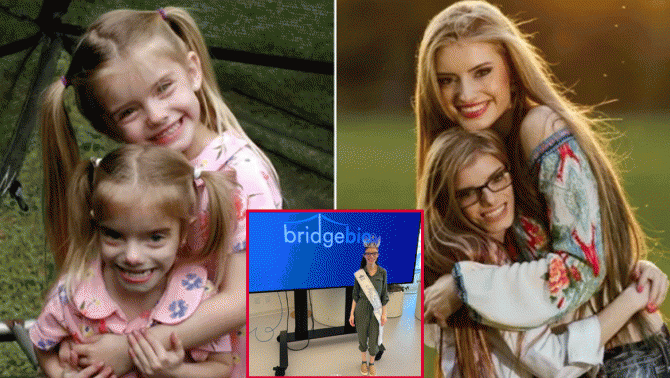 Cặp sinh đôi đặc biệt nhất thế giới: Chị cao 1m74, em chỉ 1m34, nhan sắc ‘một trời một vực’