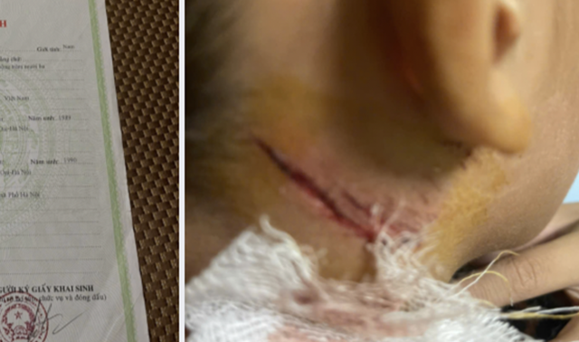 Cháu bé 11 tuổi bị hành hạ khi đi câu cá nhà hàng xóm, cơ quan chức năng vào cuộc điều tra