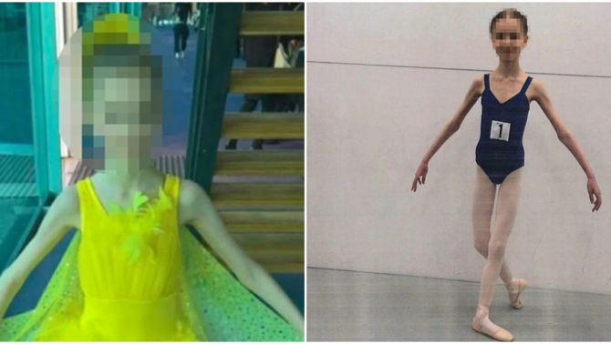 Bố mẹ của nữ diễn viên múa ballet bị bỏ tủ vì bỏ bê con gái : Cô bé bị bỏ đói, 17 tuổi nặng bằng đứa trẻ 9 tuổi
