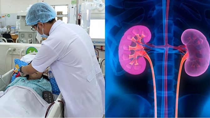 Cô gái 21 tuổi suy thận giai đoạn cuối và mắc loạt ‘bệnh người già’, bác sĩ cảnh báo thói quen sinh hoạt ở người trẻ