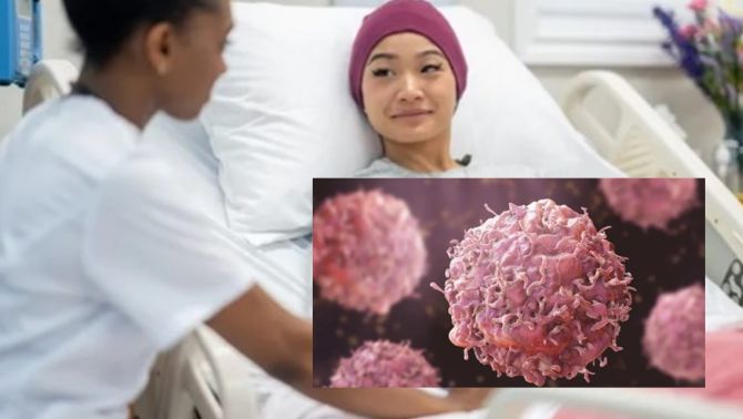 Khi nào ung thư được coi là khỏi và khi nào chỉ là thuyên giảm?