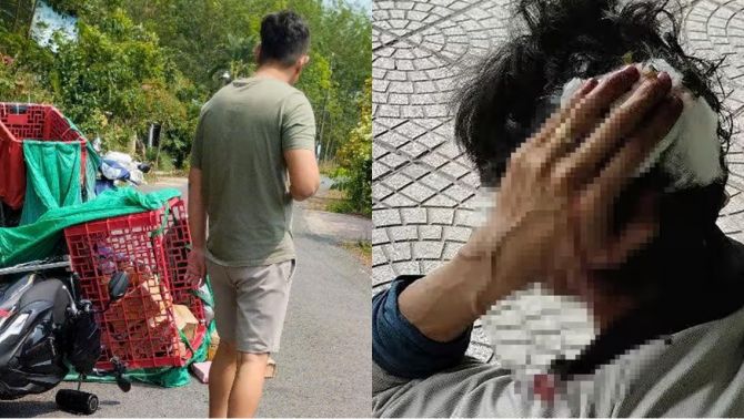 Công an lên tiếng vụ shipper ở Bình Dương bị 2 vợ chồng đánh nhập viện, hé lộ nguồn cơn sự việc