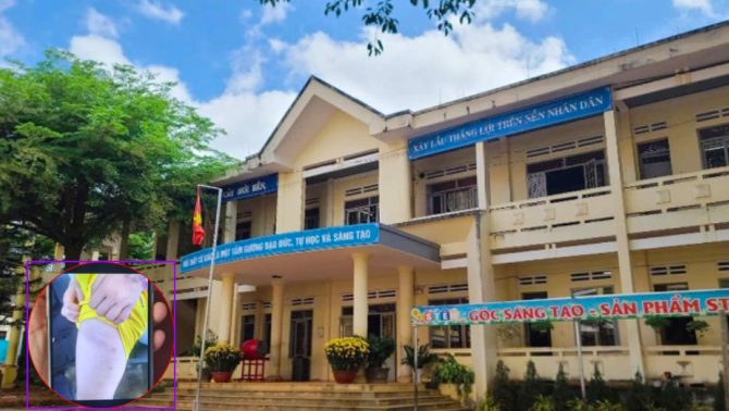 Đã có quyết định chính thức với giáo viên dùng roi điện, nhét khăn vào miệng học sinh tại Đắk Lắk