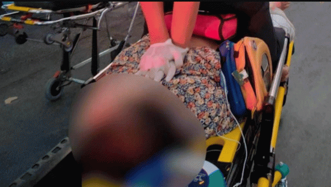 Thông tin vụ cụ bà 67 tuổi tử vong sau khi bị rụng răng giả, nguyên nhân thật sự đằng sau gây xót xa