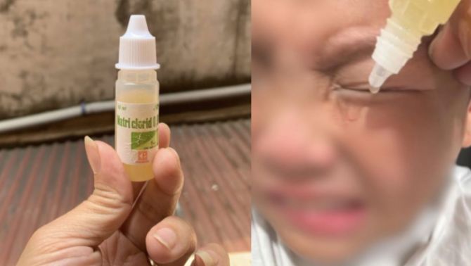 'Độc lạ' trào lưu chữa bệnh mới: Nhỏ mắt, nhỏ tai bằng nước cốt chanh khiến dân mạng dở khóc dở cười