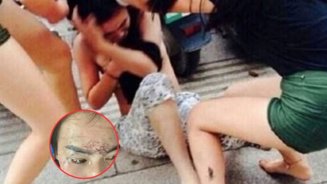 Rúng động Cà Mau: Người phụ nữ đang đi đường bất ngờ bị lôi vào tiệm spa, ‘tra tấn’ bằng axit và máy xăm 