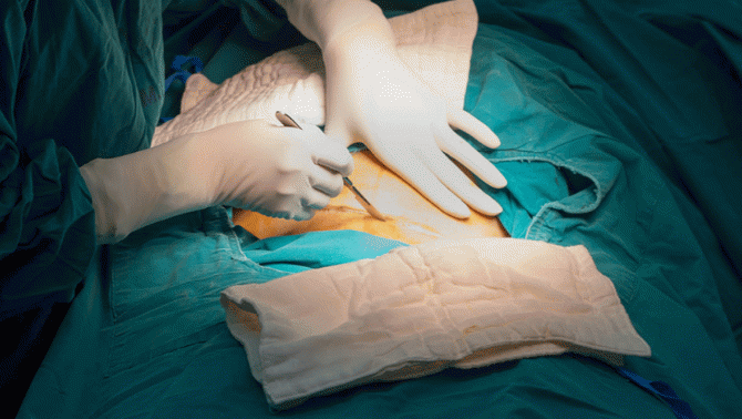 Sau 2 tháng kết hôn, người đàn ông đã tử vong khi phẫu thuật tại một bệnh viện phụ sản