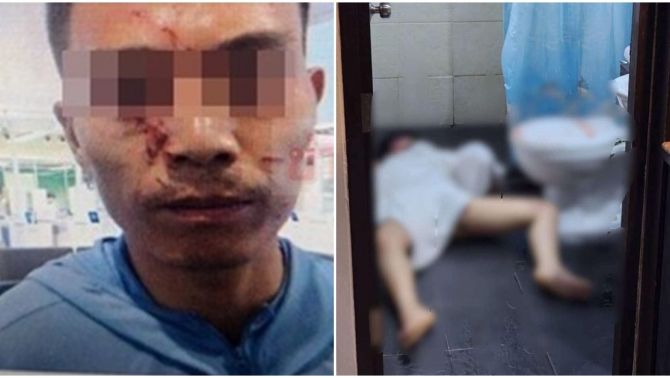 Tiết lộ chấn động vụ lá phổi bị lấy mất của cô gái bị sát hại dã man: Không có yếu tố buôn bán nội tạng