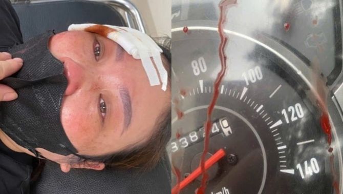 Diễn biến vụ người phụ nữ bị đánh bằng dùi cui vì không kịp nhường đường cho xe tải vượt tại Hà Đông