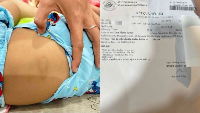 Thông tin sốc vụ bé gái 2 tuổi bị ‘chấn thương vùng kín’, cơ sở giữ trẻ tiết lộ tình tiết không ai nghĩ đến
