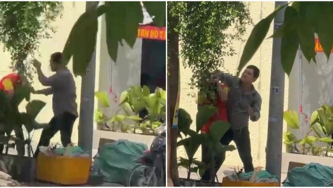 64.000 đồng và nguồn cơn nam shipper ở TP.HCM bị đánh gãy mũi