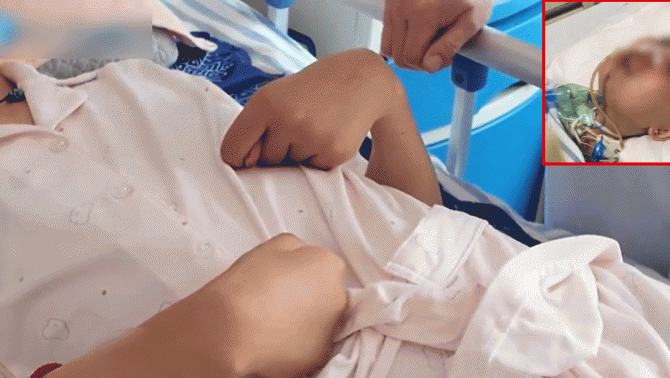 Xót xa vụ việc người mẹ bị đánh đến teo não, mặt biến dạng khi cố bảo vệ con gái 13 tuổi khỏi kẻ trộm