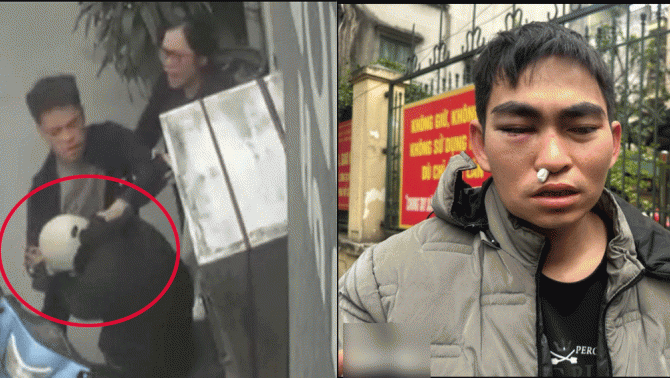 Vụ shipper khuyết tật bị tài xế xe Lexus hành hung: Tình hình hiện tại của nam shipper gây xót xa