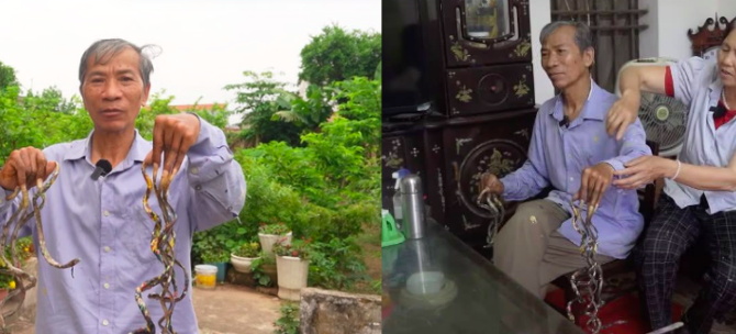 CĐM 'ngã ngửa' khi người đàn ông ở Nam Định nuôi móng tay suốt 33 năm, mong bán với giá 7 tỷ đồng