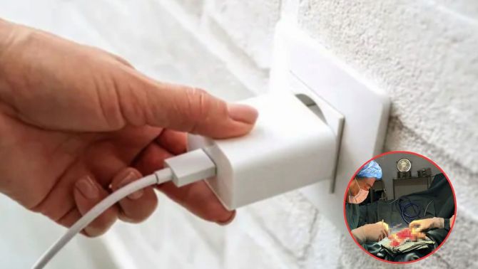  Điện Biên: Rợn người trước hình ảnh bàn tay bị nổ tung do sử dụng điện thoại khi đang sạc