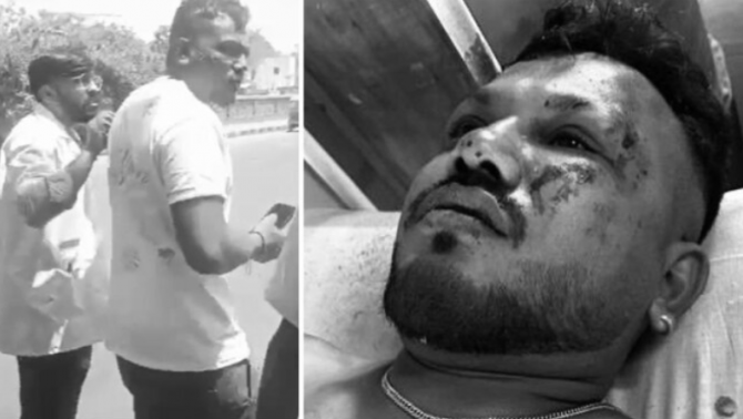 Danh tính hành khách duy nhất còn sống sau vụ tai nạn máy bay kinh hoàng ở Ấn Độ