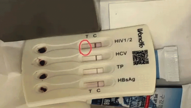 Vợ chồng trẻ sốc nặng khi phát hiện bộ xét nghiệm HIV dương tính trong túi đồ dùng khách sạn cao cấp
