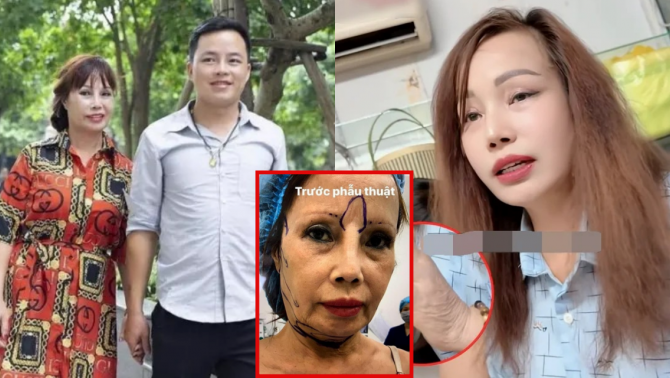 'Cô dâu Cao Bằng' lại 'dao kéo' để xứng với chồng kém 36 tuổi, ngoại hình hiện tại gây chấn động