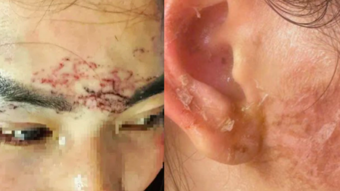 Khởi tố 2 đối tượng trong vụ đánh ghen và xăm mặt người phụ nữ gây rúng động ở Cà Mau