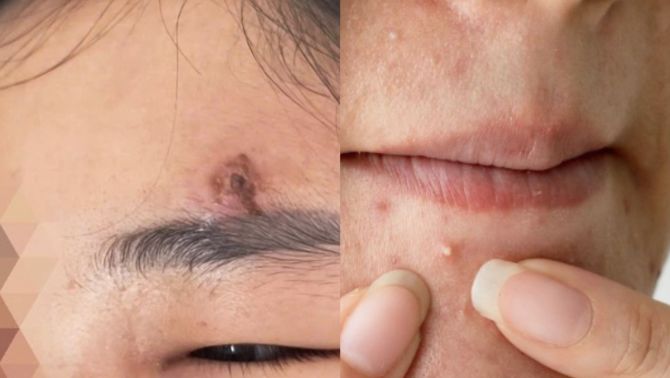 Cô gái ở Hà Nội suýt chết vì tự ý thói quen tưởng chừng vô hại, bác sĩ cảnh báo hậu quả khôn lường 