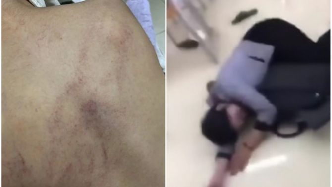 Phẫn nộ trước 'lời thú tội' từ cô giáo mầm non ở Hà Nội đánh đập, kéo lê, ném bé 4 tuổi vào tường