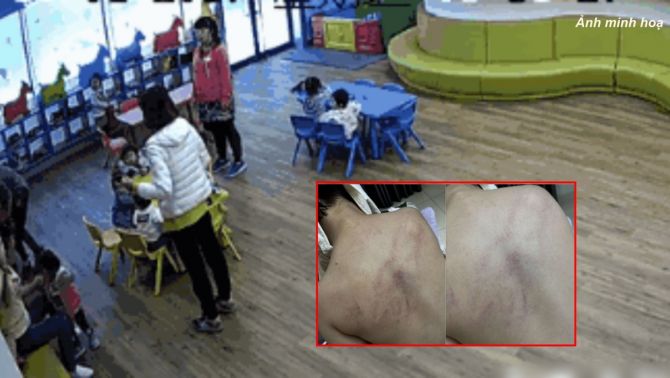 Vụ cô giáo bạo hành bé 4 tuổi ở Hà Nội: Gia đình từ chối tiết lộ danh tính vì lý do đặc biệt