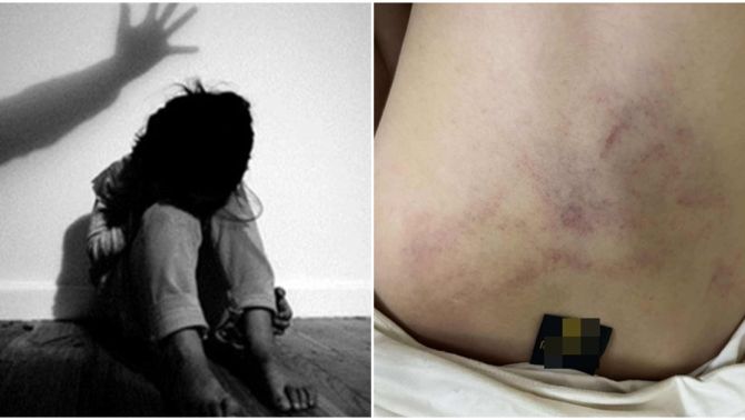 Thông tin nóng vụ bé gái 4 tuổi bị cô giáo bạo hành, kéo lê, ném vào tường, Bộ Y tế vào cuộc