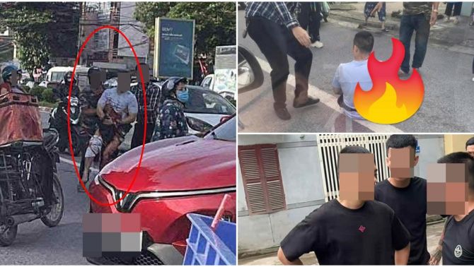 NÓNG: Cập nhật tình hình hiện tại của Tiktoker ở Thái Nguyên bị chém gần lìa bàn tay, công an vào cuộc