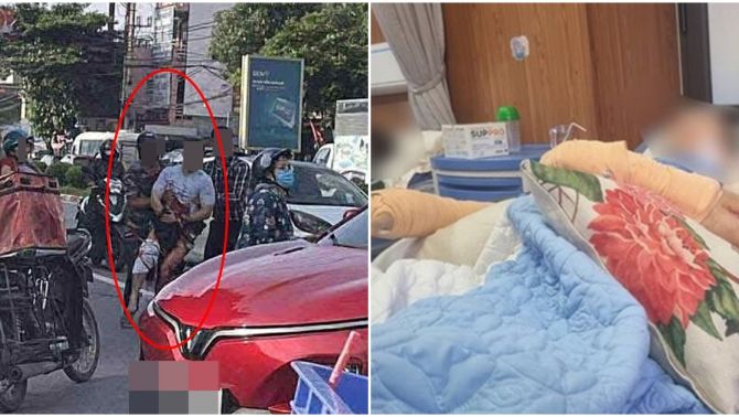 Tiktoker Hà List kinh hoàng kể khoảnh khắc bị 4 giang hồ bịt kín mặt chém lìa tay, tiết lộ nguồn cơn sự việc