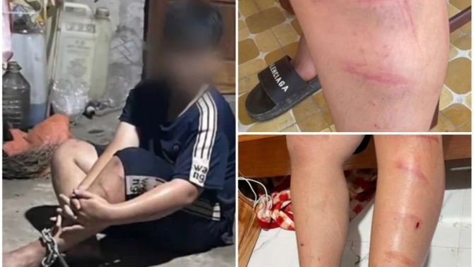 Hé lộ lý do 'chấn động' khiến người đàn ông xích chân rồi hành hung dã man cháu bé 14 tuổi ở Huế
