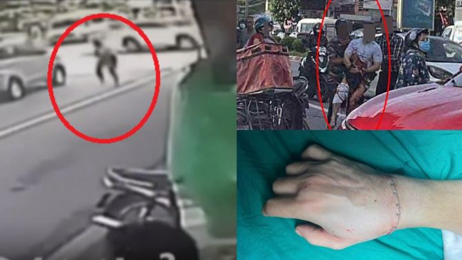 Camera ghi lại cảnh Tiktoker Hà List bị chém lìa tay: 30 giây ‘ra tay’ đầy lạnh lùng giữa phố 