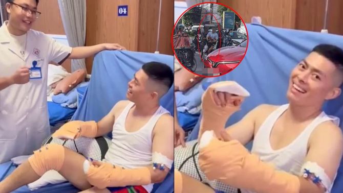 Hà Lits hồi phục thần tốc sau vụ chém lìa tay: Bao lâu có thể sinh hoạt như bình thường?