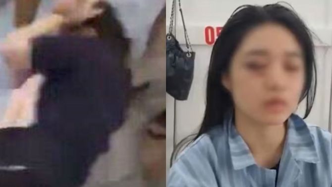 Phẫn nộ: Nữ sinh lớp 11 ở Hưng Yên bị đánh hội đồng dã man, nhập viện trong hoảng loạn