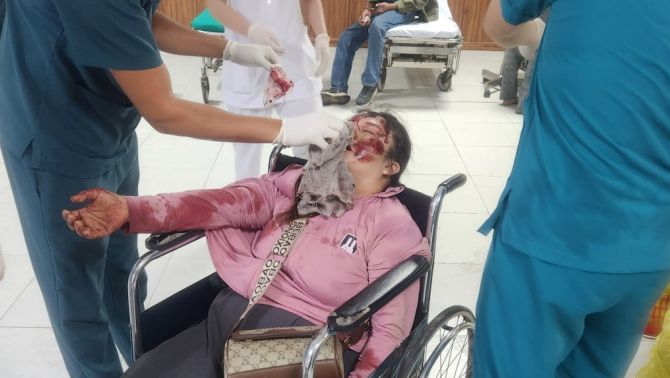 Cơn giông chiều 19/7: Một người phụ nữ ở Hưng Yên bị tấm tôn bắn vào mặt phải đi cấp cứu, ảnh hiện trường gây ám ảnh