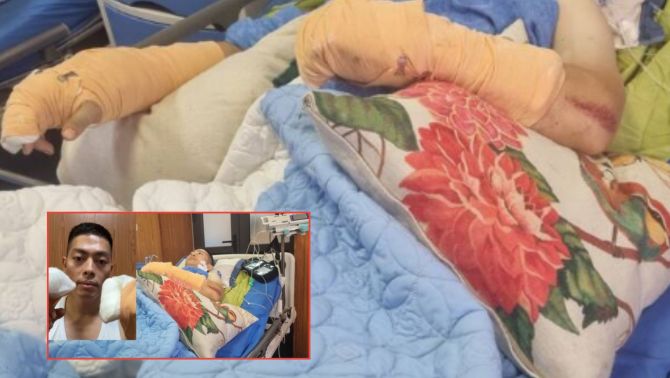 Tiktoker Hà List suýt mất tay vì nợ nần, bất ngờ thông báo livestream kể toàn bộ sự thật khi xuất viện