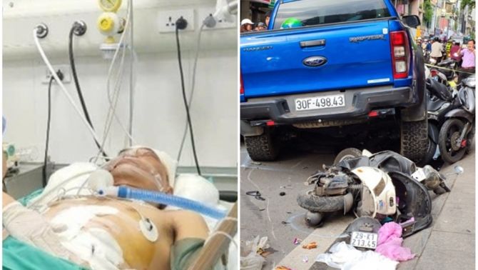 Tin vui về tình hình sức khỏe người đàn ông nguy kịch vụ tông xe liên hoàn ở Khâm Thiên, Hà Nội
