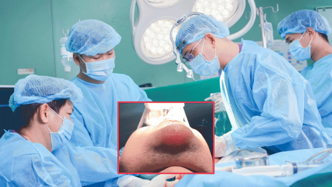 Cằm của nam thanh niên ‘phát sáng’ do tiêm filler, tình trạng hiện tại sau ca phẫu thuật khẩn cấp?