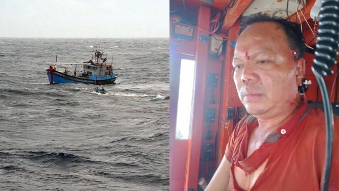 Thuyền trưởng bị chém giữa biển Vũng Tàu: Nhóm tàu lạ ra tay tàn độc, thủ đoạn khó tin